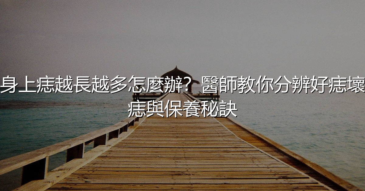 身上痣越長越多怎麼辦?醫師教你分辨好痣壞痣與保養秘訣 - 生活百科文章特色圖片